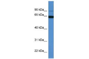 WB Suggested Anti-MAP6 Antibody Titration: 0.