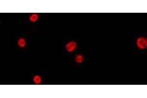 ABIN6275391 staining HepG2 by IF/ICC. (CDC40 抗体)
