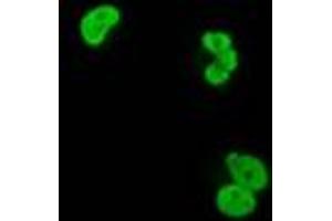 Anti-XRCC1 mouse monoclonal antibody (ABIN2453797) immunofluorescent staining of COS7 cells transiently transfected by pCMV6-ENTRY XRCC1 (RC204952). (XRCC1 抗体)