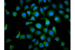 Immunofluorescence staining of A549 cells with ABIN7172685 at 1:166, counter-stained with DAPI. (TAF4B 抗体  (AA 132-244))