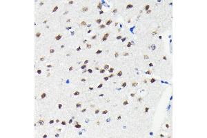 Immunohistochemistry (IHC) image for anti-Cullin 3 (CUL3) antibody (ABIN7266543)