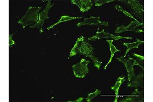 Immunofluorescence of monoclonal antibody to REN on HeLa cell. (Renin 抗体  (AA 24-406))