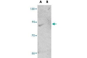 Western blot analysis of FAM59A in rat liver tissue lysate with FAM59A polyclonal antibody  at (A) 1 and (B) 2 ug/mL . (FAM59A 抗体  (C-Term))