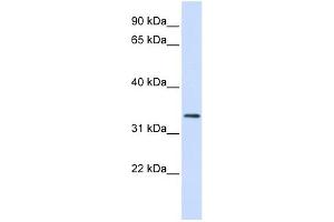 FBXO25 antibody used at 1 ug/ml to detect target protein. (FBXO25 抗体  (N-Term))