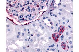 Anti-ERBB4 antibody IHC of human kidney. (ERBB4 抗体  (Internal Region))