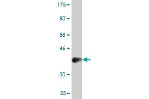 Western Blot detection against Immunogen (37. (PAX8 抗体  (AA 141-250))
