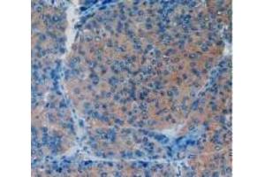 Immunohistochemistry (IHC) image for anti-Vascular Cell Adhesion Molecule 1 (VCAM1) (AA 109-318) antibody (ABIN7431959)