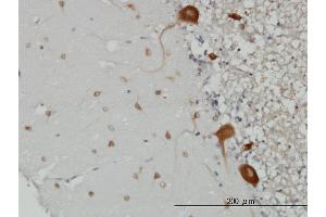Immunoperoxidase of monoclonal antibody to FARSLB on formalin-fixed paraffin-embedded human cerebellum. (FARSB 抗体  (AA 234-341))