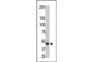 The anti-HtrA3 N-term Pab (ABIN1882095 and ABIN2846350) is used in Western blot to detect HtrA3 in rat testis tissue lysate. (HTRA3 抗体  (N-Term))