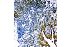 IHC analysis of Thioredoxin TRX using anti-Thioredoxin TRX antibody (ABIN6719381). (TXN 抗体  (AA 2-105))