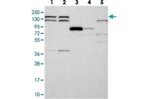 Western blot analysis of Lane 1: RT-4, Lane 2: U-251 MG, Lane 3: Human Plasma, Lane 4: Liver, Lane 5: Tonsil with DHX38 polyclonal antibody  at 1:250-1:500 dilution. (DHX38 抗体)