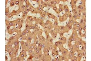 Immunohistochemistry of paraffin-embedded human liver tissue using ABIN7158476 at dilution of 1:100 (CES1 抗体  (AA 291-566))
