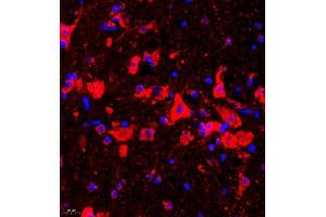 Immunofluorescence of paraffin embedded mouse epencephalon using UTS2 (ABIN7076162) at dilution of 1:2000 (400x lens) (Urotensin 2 抗体)