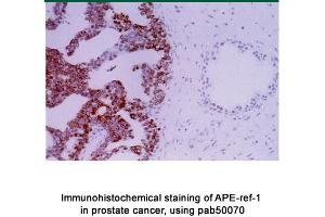 Image no. 2 for anti-Apurinic/Apyrimidinic Endonuclease 1 (APEX1) antibody (ABIN363379) (APEX1 抗体)
