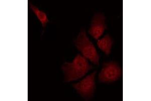 ABIN6274503 staining Hela by IF/ICC. (ILKAP 抗体  (N-Term))