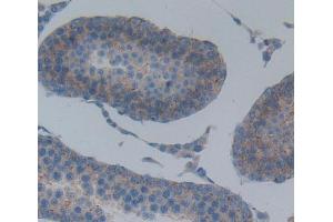 Immunohistochemistry (IHC) image for anti-ATP-Binding Cassette, Sub-Family B (MDR/TAP), Member 8 (ABCB8) (AA 468-714) antibody (ABIN5013187)