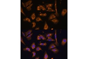 Immunofluorescence (IF) image for anti-Eukaryotic Translation Initiation Factor 5B (EIF5B) (AA 1-273) antibody (ABIN7267052)