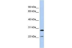 Host:  Rabbit  Target Name:  FGB  Sample Type:  MCF7 Whole Cell lysates  Antibody Dilution:  1. (Fibrinogen beta Chain 抗体  (Middle Region))
