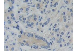 Immunohistochemistry (IHC) image for anti-phosphofructokinase, Platelet (PFKP) (AA 553-753) antibody (ABIN7434014)