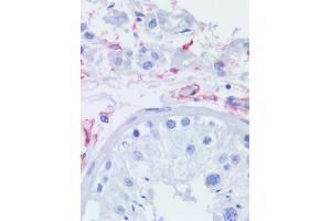 Immunohistochemistry staining of human testis (paraffin sections) using anti-CD271 (NGFR5). (NGFR 抗体)