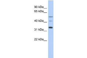 WB Suggested Anti-TCP11 Antibody Titration: 0. (TCP11 抗体  (Middle Region))