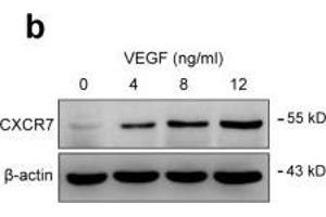 Western Blotting (WB) image for anti-Chemokine (C-X-C Motif) Receptor 7 (CXCR7) antibody (ABIN2857021)