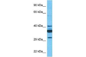 Host:  Rabbit  Target Name:  SLC35C1  Sample Type:  721_B Whole Cell lysates  Antibody Dilution:  1. (SLC35C1 抗体  (C-Term))