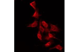 ABIN6267614 staining NIH-3T3 by IF/ICC. (PKC zeta 抗体  (pThr560))
