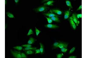 Immunofluorescence staining of Hela cells with ABIN7149997 at 1:100, counter-stained with DAPI. (MVD 抗体  (AA 69-221))