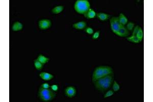 Immunofluorescent analysis of PC-3 cells using ABIN7163117 at dilution of 1:100 and Alexa Fluor 488-congugated AffiniPure Goat Anti-Rabbit IgG(H+L) (TAM41 抗体  (AA 161-452))