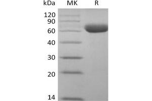 Western Blotting (WB) image for Sialic Acid Binding Ig-Like Lectin 15 (SIGLEC15) (Active) protein (Fc Tag) (ABIN7321036) (SIGLEC15 Protein (Fc Tag))