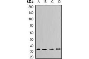 Western blot analysis of CapZ alpha-2 expression in Hela (A), THP1 (B), mouse brain (C), mouse heart (D) whole cell lysates.