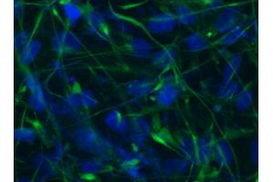 Image no. 1 for anti-Nestin (NES) antibody (ABIN335378) (Nestin 抗体)