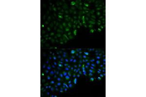 Immunofluorescence analysis of U2OS cell using HK2 antibody. (Hexokinase 2 抗体)