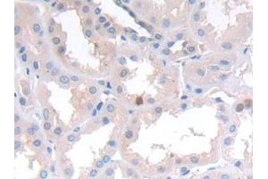 Detection of NCAD in Human Kidney Tissue using Polyclonal Antibody to N-cadherin (NCAD) (N-Cadherin 抗体  (AA 685-784))