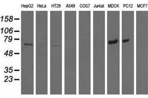 Western blot analysis of extracts (35 µg) from 9 different cell lines by using anti-MTMR14 monoclonal antibody. (MTMR14 抗体)