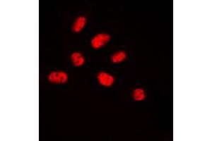 Immunofluorescent analysis of NET (pS357) staining in HUVEC cells. (ELK3 抗体  (C-Term, pSer357))