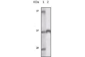 Western blot analysis using TYRO3 mouse mAb against truncated TYRO3 recombinant protein.
