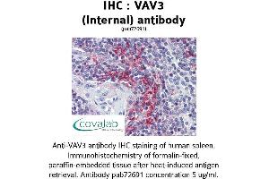 Image no. 2 for anti-Vav 3 Oncogene (VAV3) (Internal Region) antibody (ABIN1740680) (VAV3 抗体  (Internal Region))