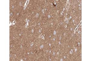 ABIN6267617 at 1/200 staining human brain tissue sections by IHC-P. (PKC delta 抗体  (pSer645))