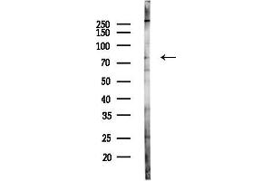 Western blot analysis of lysates from HUVEC cells(LPS 4h treatment), using FZ Antibody at 1/1000 dilution.