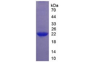 SDS-PAGE analysis of Human Interleukin 1 zeta Protein. (IL-37 蛋白)