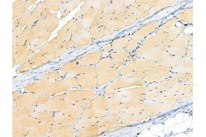 ABIN6255205 and ABIN6267091 at 1/100 staining Rat skin tissue by IHC-P. (TBC1D4 抗体  (pSer318))