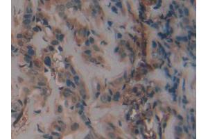 Immunohistochemistry (IHC) image for anti-Plasminogen Activator Inhibitor 1 (SERPINE1) (AA 25-402) antibody (ABIN1078449)