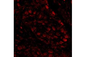 Immunofluorescence (IF) image for anti-Poly (ADP-Ribose) Polymerase 1 (PARP1) (AA 50-100) antibody (ABIN7448996)
