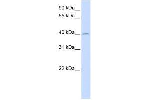 ACAA2 antibody used at 1 ug/ml to detect target protein.