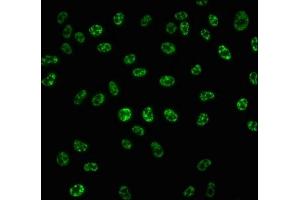 Immunofluorescence staining of Hela cells with ABIN7127746 at 1:100,counter-stained with DAPI.
