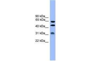 Image no. 1 for anti-serpin Peptidase Inhibitor, Clade A (Alpha-1 Antiproteinase, Antitrypsin), Member 4 (SERPINA4) (AA 271-320) antibody (ABIN6745377) (SERPINA4 抗体  (AA 271-320))