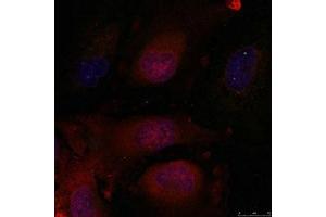 Immunofluorescence staining of methanol-fixed Hela cells using JunD(Ab-255) Antibody. (JunD 抗体)