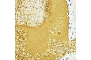 Immunohistochemistry of paraffin-embedded mouse liver using IGF1 antibody (ABIN6134370, ABIN6142231, ABIN6142233 and ABIN6215544) at dilution of 1:100 (40x lens). (IGF1 抗体  (AA 50-150))